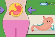 মেদ ঝরলে কি পাকস্থলীর আকারও কমে! পেটের ভেতর কিন্তু নানা কাণ্ড ঘটে পাকস্থলী এমন একটা অঙ্গ যার সঙ্কোচন আর প্রসারণ চলতেই থাকে। ভরপুর খাবার তার থলিতে ঢুকলে সে আকারে বেড়ে যায়, তারপর ক্রমাগত নিজেকে বাড়িয়ে আর কমিয়ে সে খাবার সদগতি করে। অর্থাৎ খাবার হজম করায়।